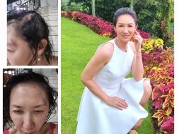 Sherly Chebing Bangkit dari Trauma, Menjadi Suara bagi Korban Kekerasan